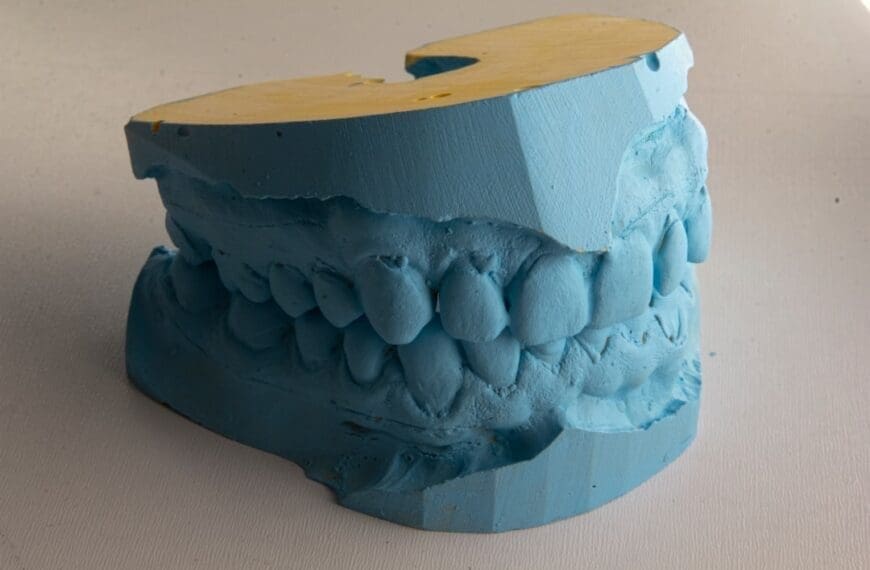 Improving Sleep with a Mandibular Advancement Device