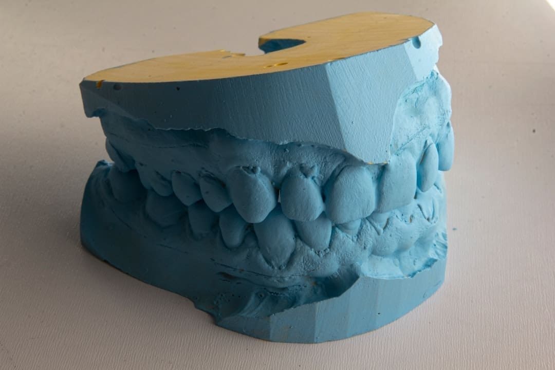 Improving Sleep with a Mandibular Advancement Device